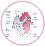 Label the parts of the human heart diagram